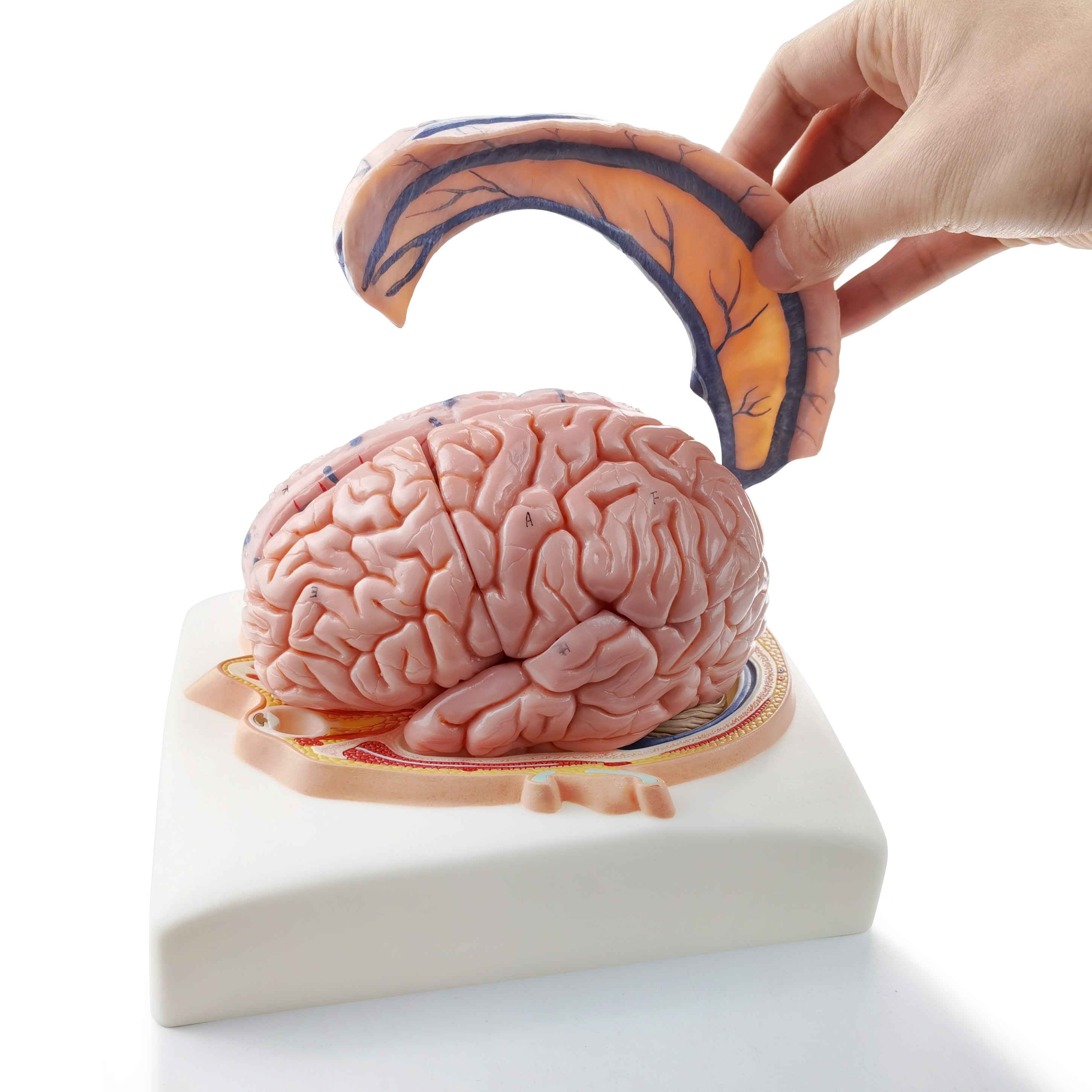 Evotech Deluxe Brain Model on Cranial Plain, W/ Dura Mater & Arteries, 7 Parts, Life Size