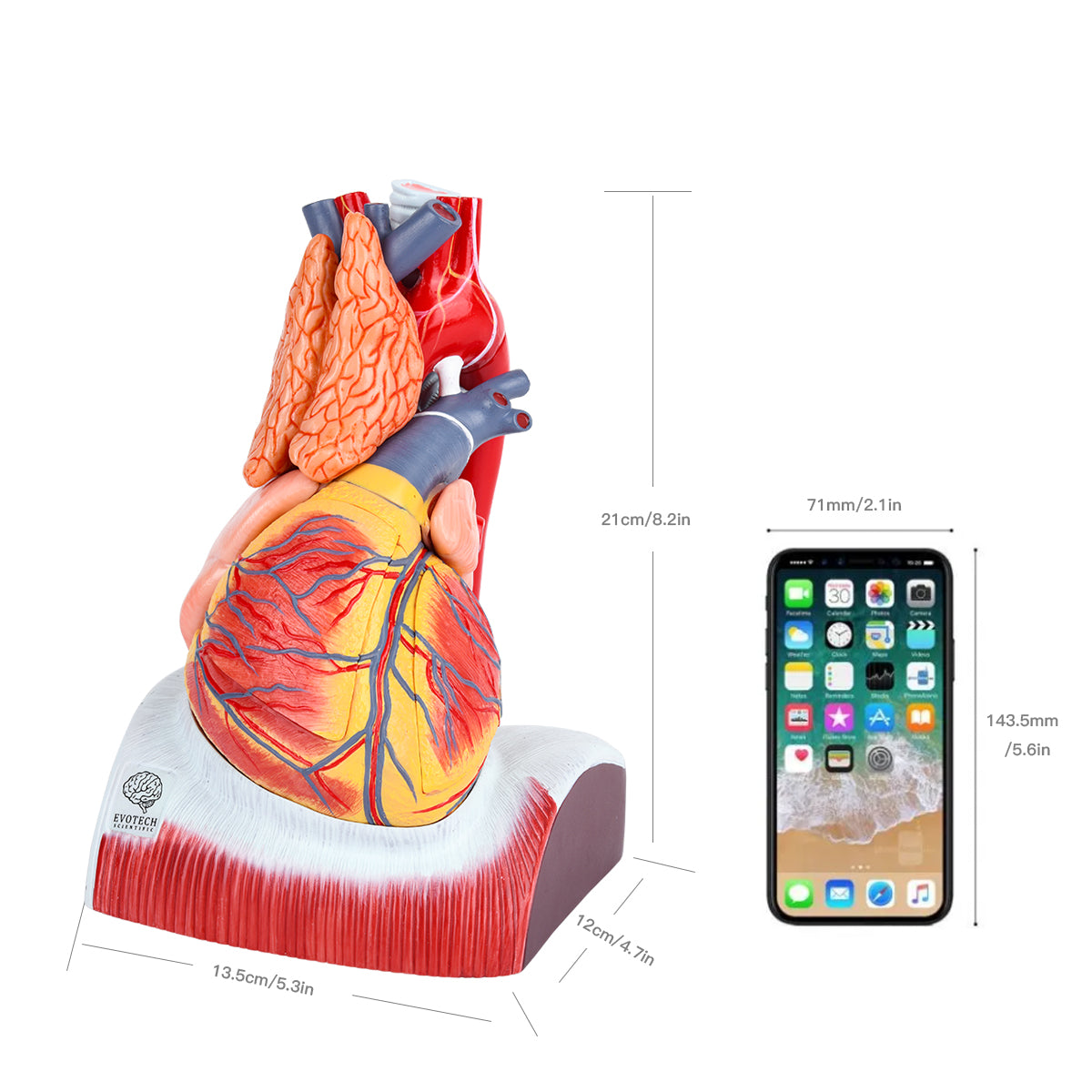 Evotech Scientific Deluxe 10 Parts 1.5X Life Size Large Human Anatomical Heart Model with Thymus Gland & Diaphram Base