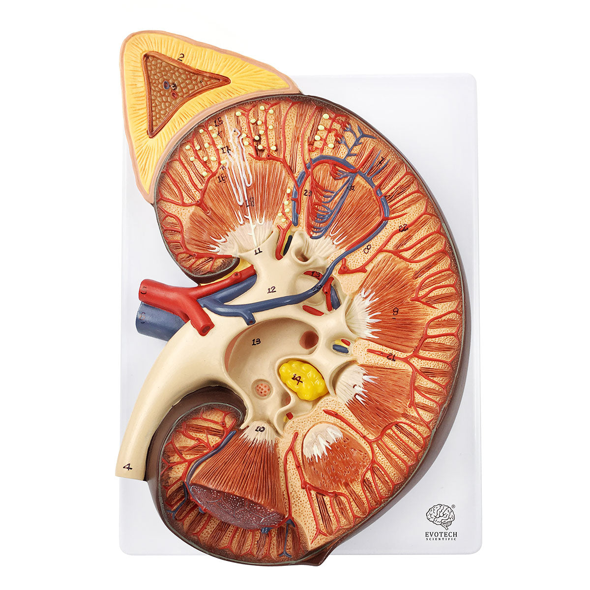 Evotech Scientific Human Kidney Model 3X Life-Size Model Includes Anatomy of Adrenal Gland and Nephrons