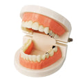 Evotech Scientific Decay Teeth Model, Dental Teeth Model Caries Standard Teeth Teaching Model Study Tool Adult Disease Standard Typodont Demonstration Teeth Model