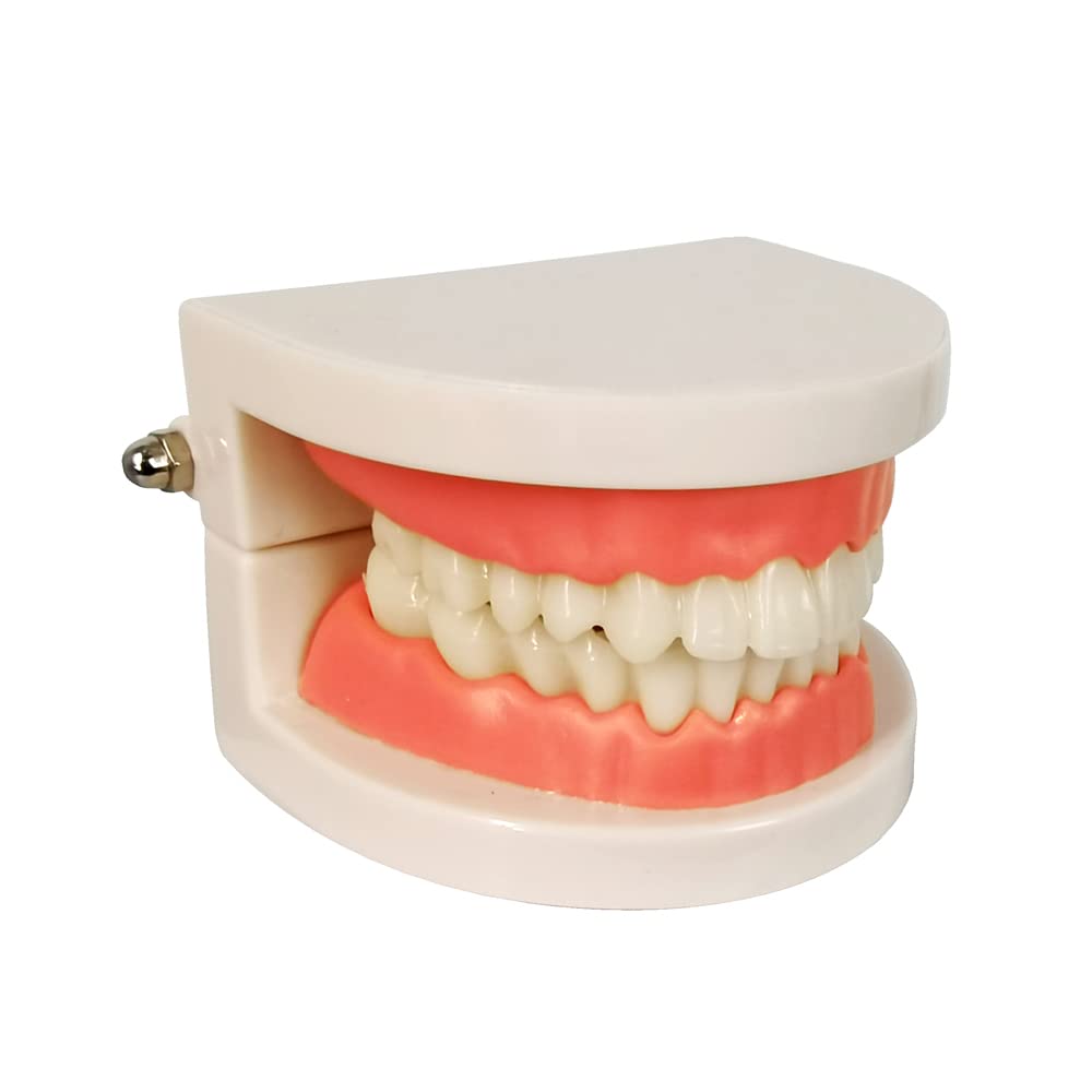 Evotech Scientific Decay Teeth Model, Dental Caries Standard Teeth Teaching Model Study Tool Adult Disease Standard Typodont Demonstration Teeth Model
