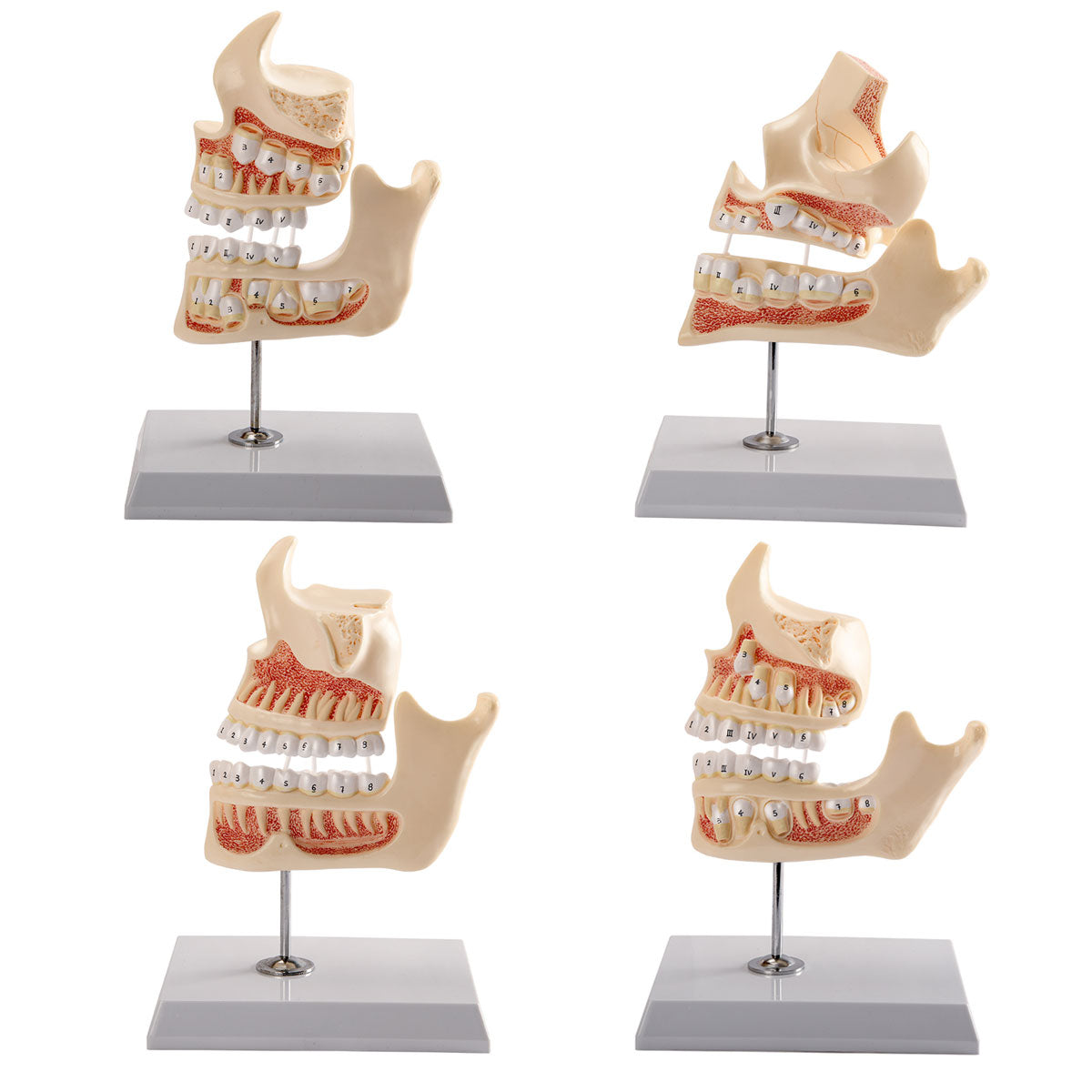 Evotech Scientific Development of a Set of Teeth, 4-Stage, Life Size, 4 Parts, on Base & Stand