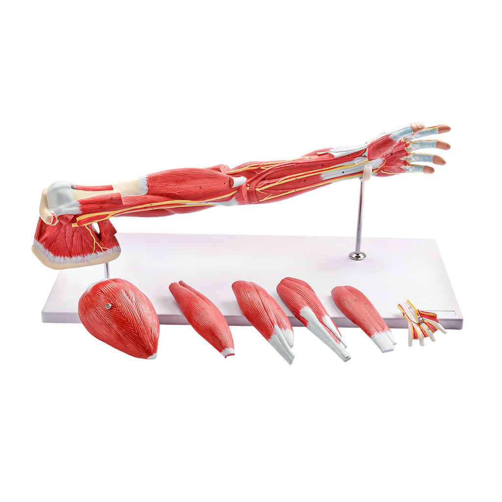 Evotech Scientific Anatomical Muscular Arm Model, Life Size, 7 Parts