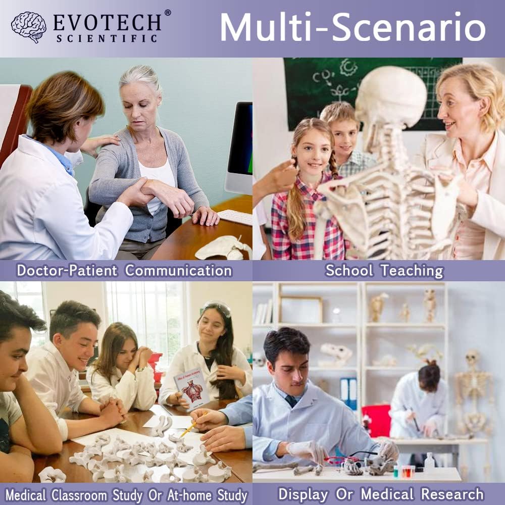 Evotech Scientific Disarticulated Human Skeleton Model for Anatomy 67'' Full Size Skeleton Model W/Half Size15Pcs Exploded Skull, Skull, Spine, Bones, Articulated Hand Foot