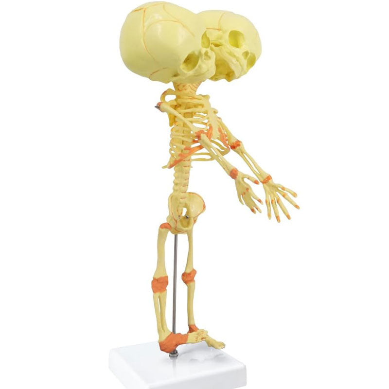 Evotech Scientific Human Infant Skeleton Model, Twin-Skull, Human Fetus Skeleton W/Double-Skull Model
