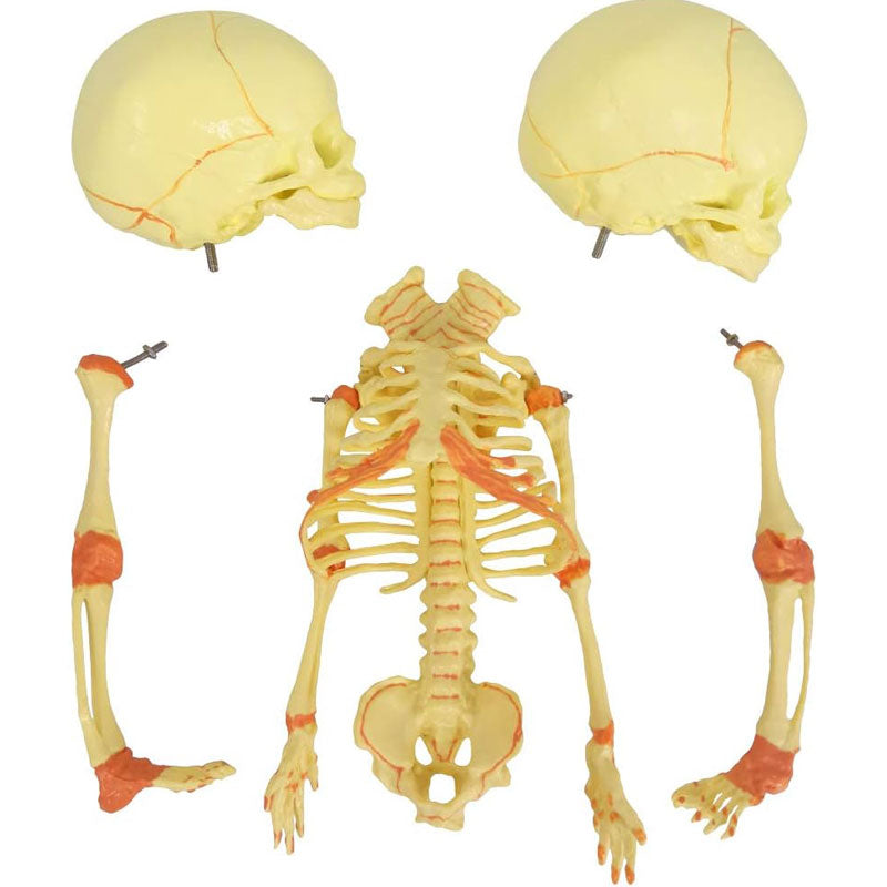 Evotech Scientific Human Infant Skeleton Model, Twin-Skull, Human Fetus Skeleton W/Double-Skull Model