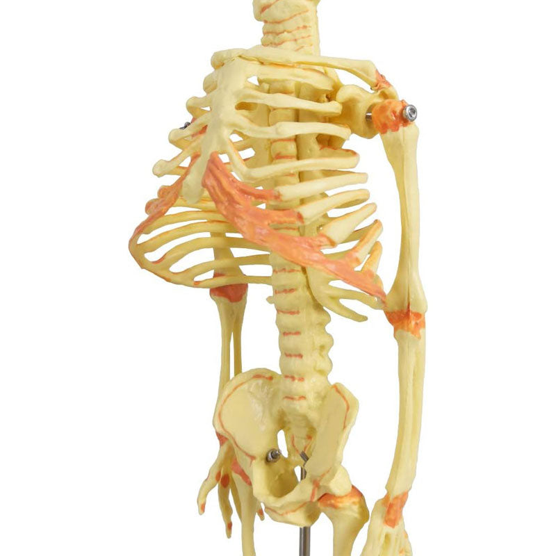 Evotech Scientific Human Infant Skeleton Model, Twin-Skull, Human Fetus Skeleton W/Double-Skull Model