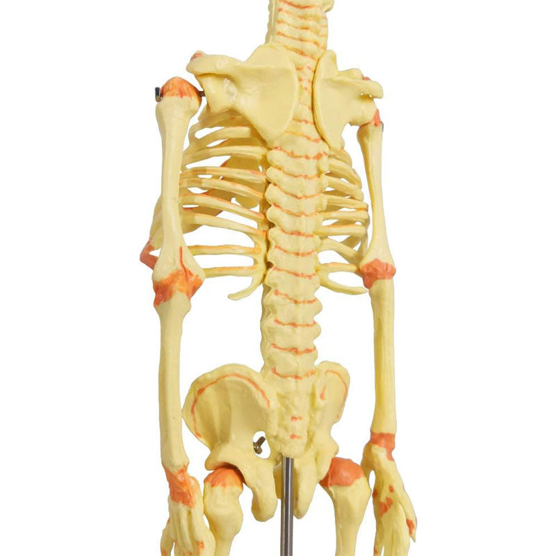 Evotech Scientific Human Infant Skeleton Model, Twin-Skull, Human Fetus Skeleton W/Double-Skull Model