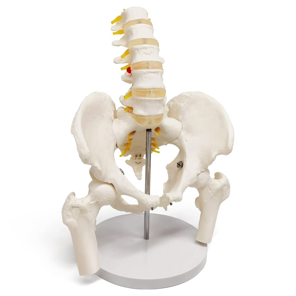 Evotech Scientific Life Size Male Pelvis Model with 5 Lumbar Spine, W/ Removable Femur Head