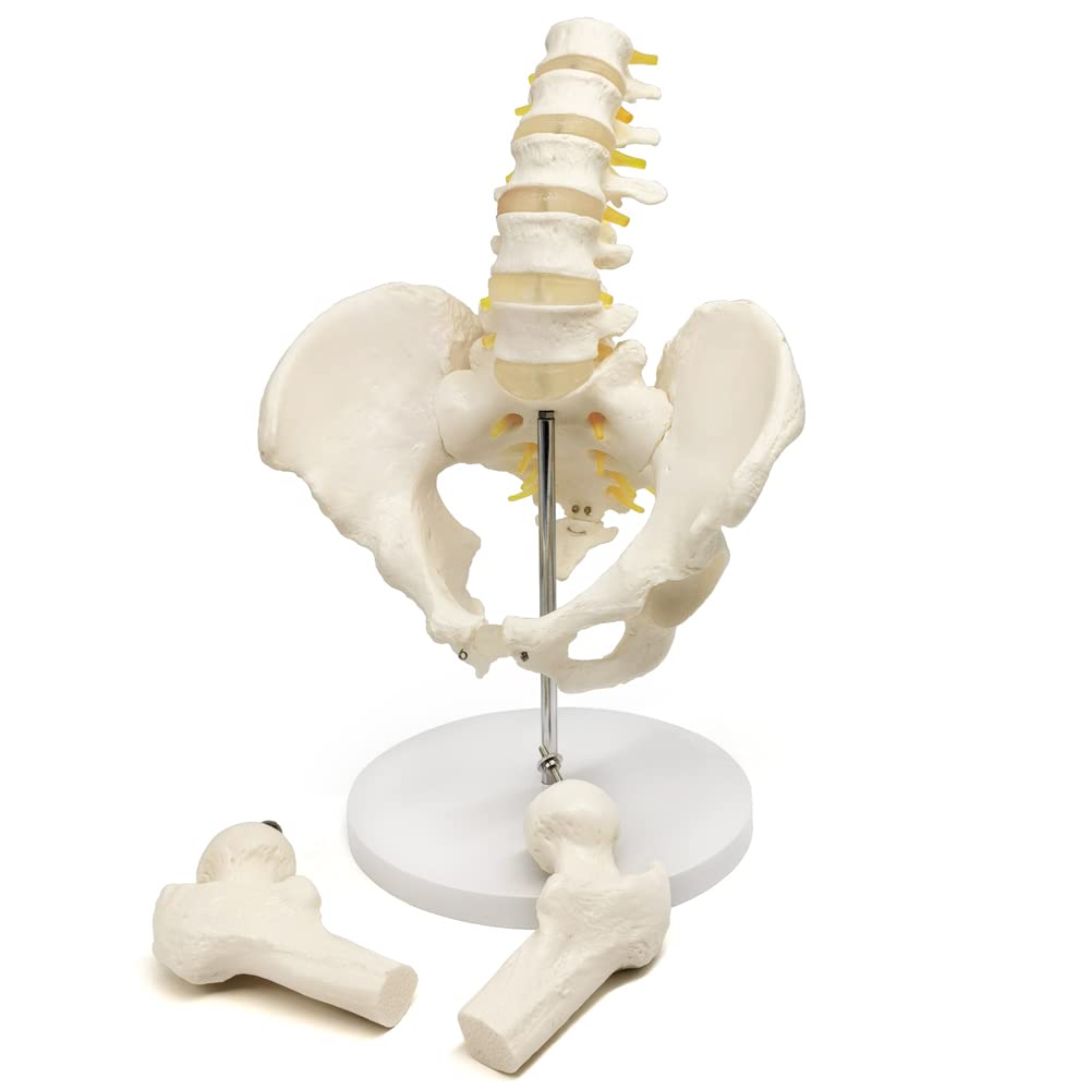 Evotech Scientific Life Size Male Pelvis Model with 5 Lumbar Spine, W/ Removable Femur Head
