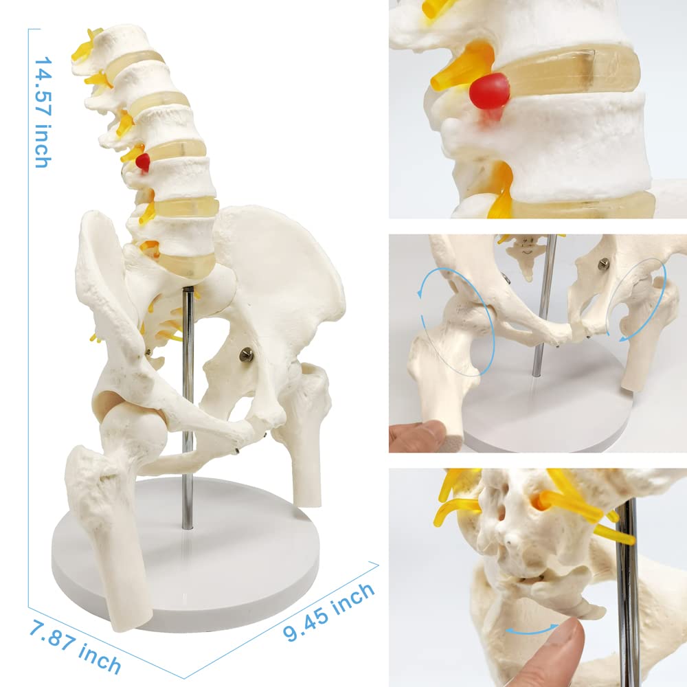 Evotech Scientific Life Size Male Pelvis Model with 5 Lumbar Spine, W/ Removable Femur Head