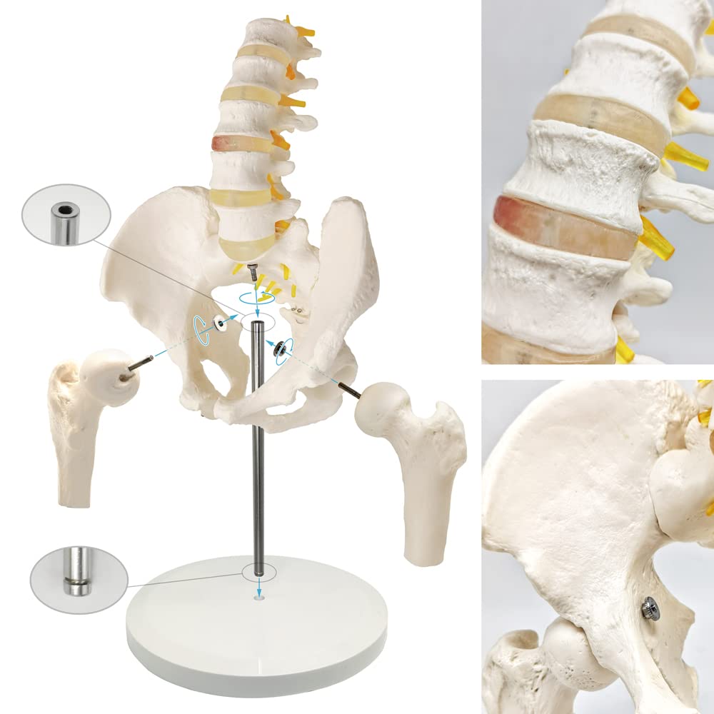 Evotech Scientific Life Size Male Pelvis Model with 5 Lumbar Spine, W/ Removable Femur Head