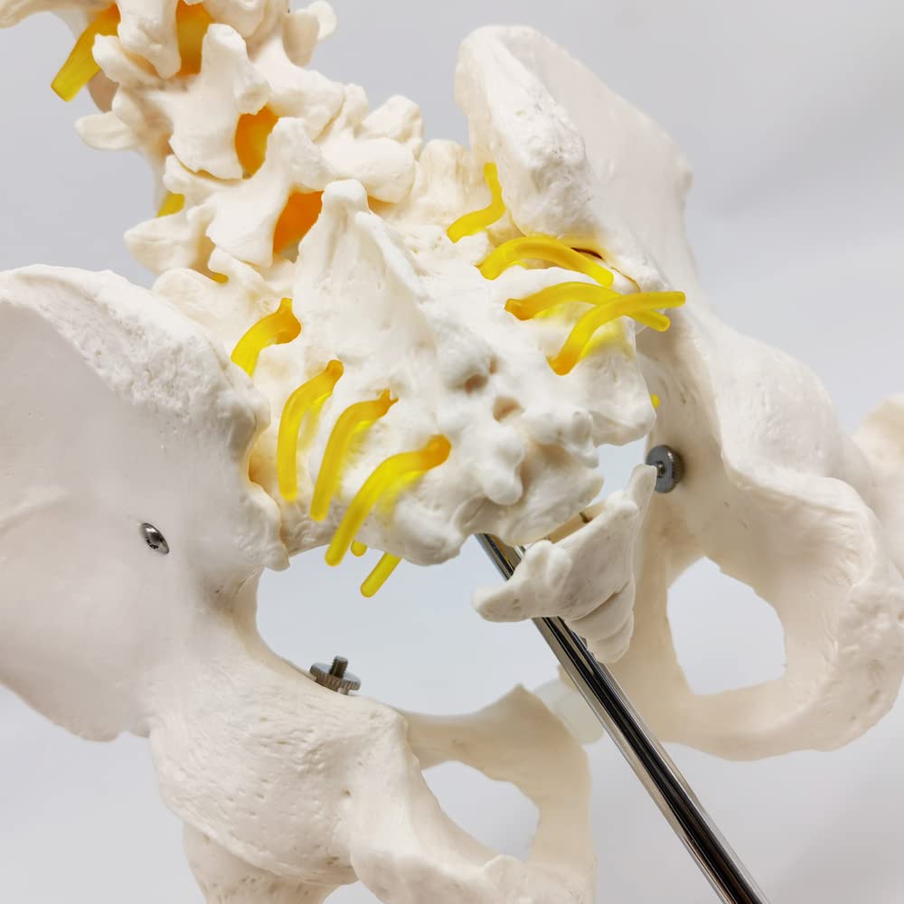 Evotech Scientific Life Size Male Pelvis Model with 5 Lumbar Spine, W/ Removable Femur Head