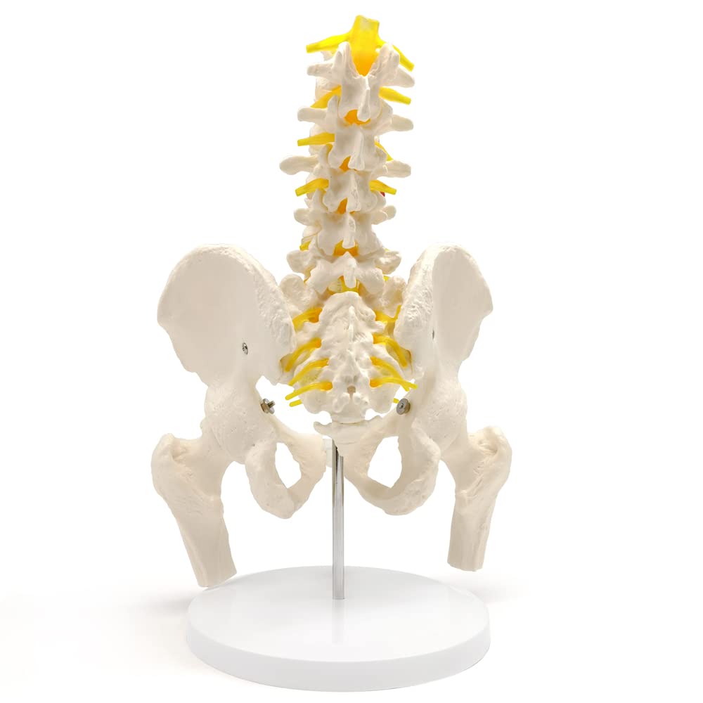 Evotech Scientific Life Size Male Pelvis Model with 5 Lumbar Spine, W/ Removable Femur Head