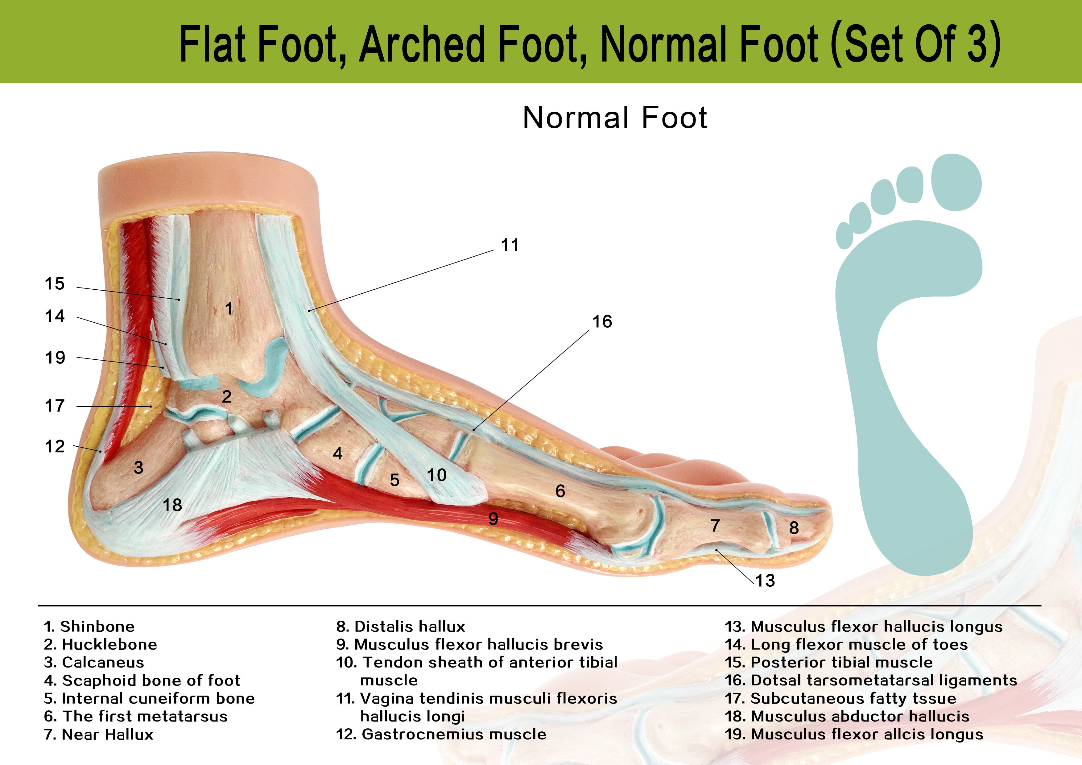 Evotech Scientific Podiatry Anatomy Models, Set of 3 Human Feet Flat Foot, Normal Foot and a High Arch