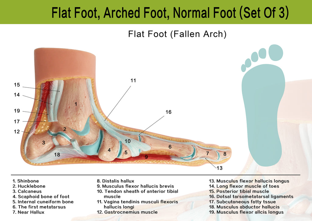 Evotech Scientific Podiatry Anatomy Models, Set of 3 Human Feet Flat Foot, Normal Foot and a High Arch
