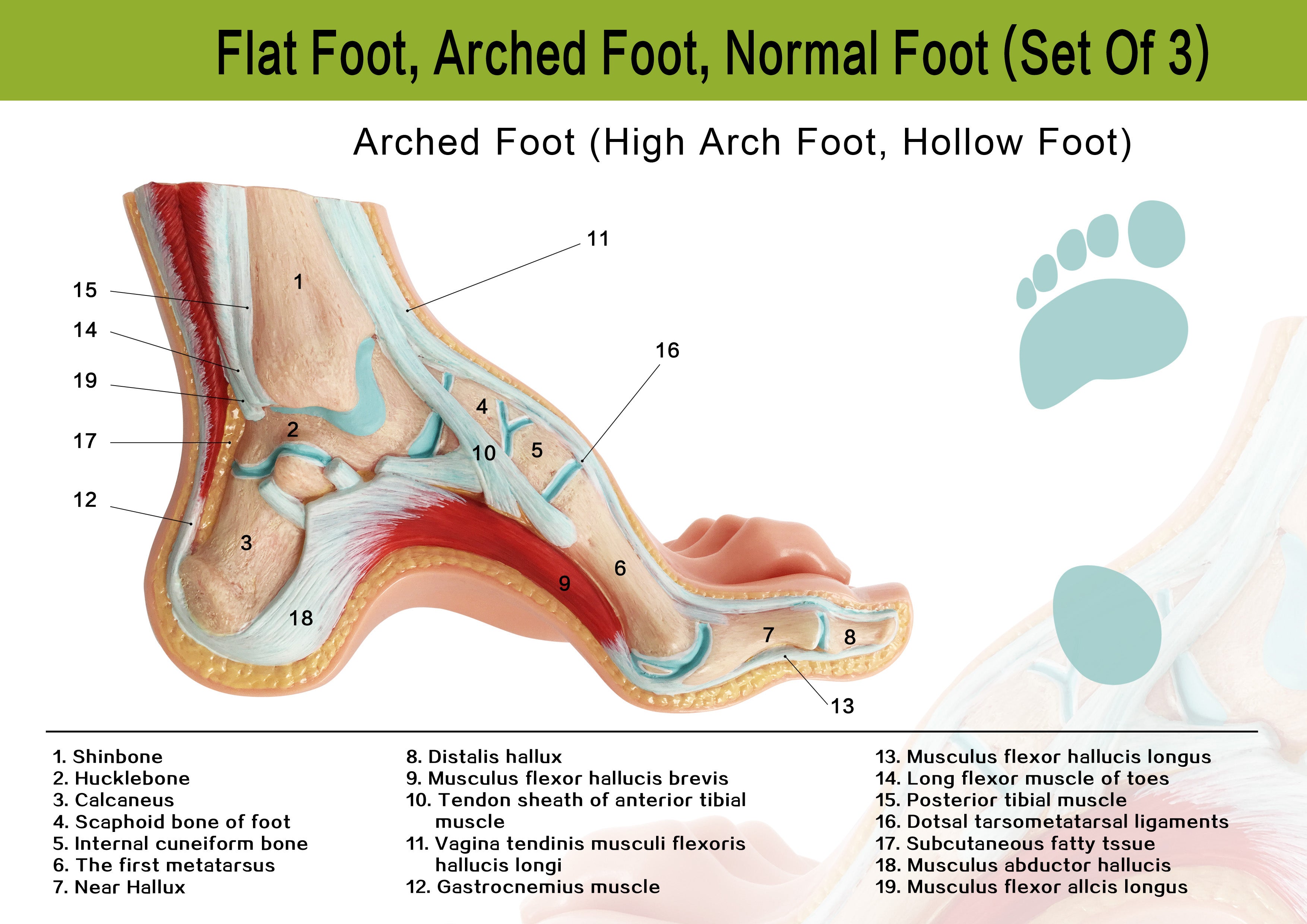 Evotech Scientific Podiatry Anatomy Models, Set of 3 Human Feet Flat Foot, Normal Foot and a High Arch