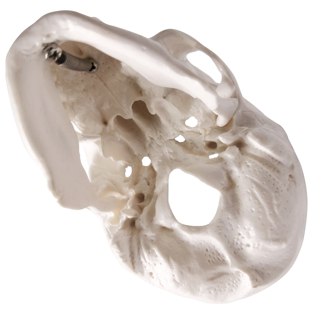 Palm-Sized Mini Human Skull Model, 3-Part (Skullcap, Base of Skull, Mandible)