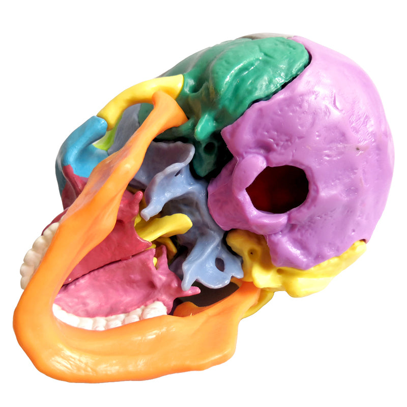 Evotech Scientific 15 Parts Palm-Sized Anatomy Exploded Detachable Human Skull Model