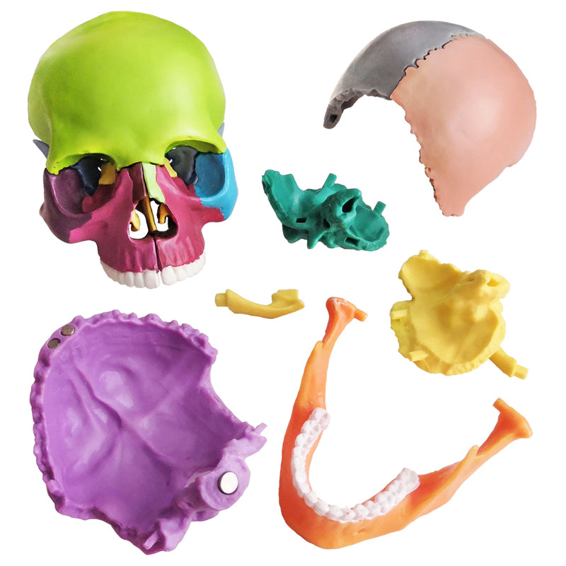 Evotech Scientific 15 Parts Palm-Sized Anatomy Exploded Detachable Human Skull Model