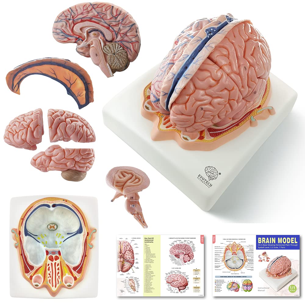 Evotech Deluxe Brain Model on Cranial Plain, W/ Dura Mater & Arteries, 7 Parts, Life Size