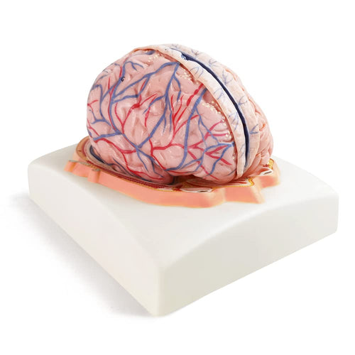 Evotech Deluxe Brain Model on Cranial Plain, W/ Dura Mater & Arteries, 7 Parts, Life Size