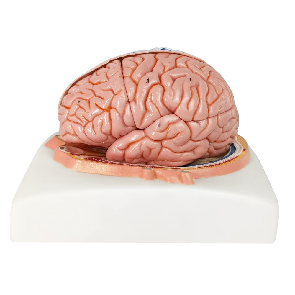 Evotech Deluxe Brain Model on Cranial Plain, W/ Dura Mater & Arteries, 7 Parts, Life Size