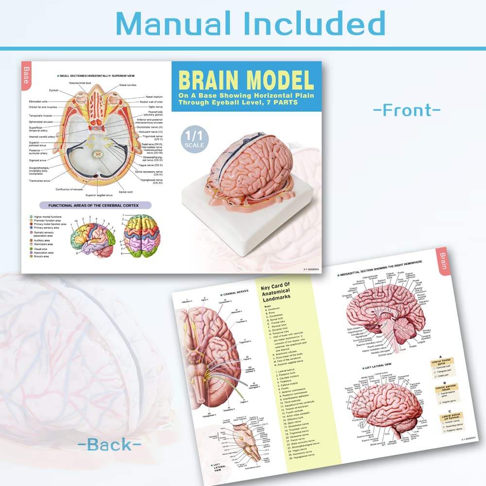 Evotech Deluxe Brain Model on Cranial Plain, W/ Dura Mater & Arteries, 7 Parts, Life Size
