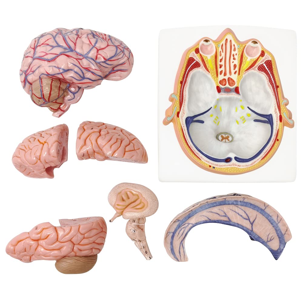 Evotech Deluxe Brain Model on Cranial Plain, W/ Dura Mater & Arteries, 7 Parts, Life Size