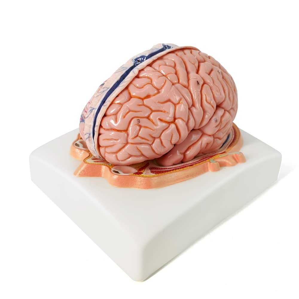 Evotech Deluxe Brain Model on Cranial Plain, W/ Dura Mater & Arteries, 7 Parts, Life Size