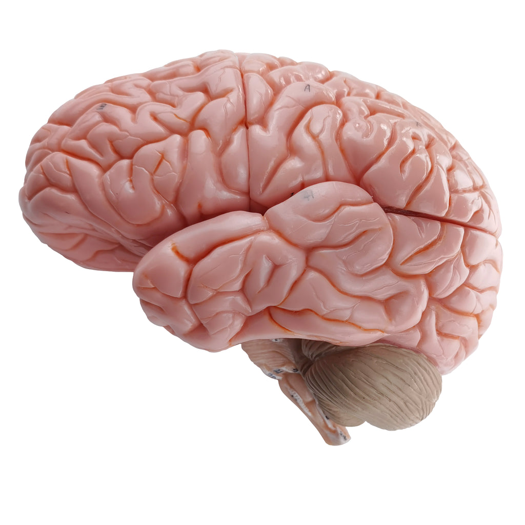 Evotech Deluxe Brain Model on Cranial Plain, W/ Dura Mater & Arteries, 7 Parts, Life Size