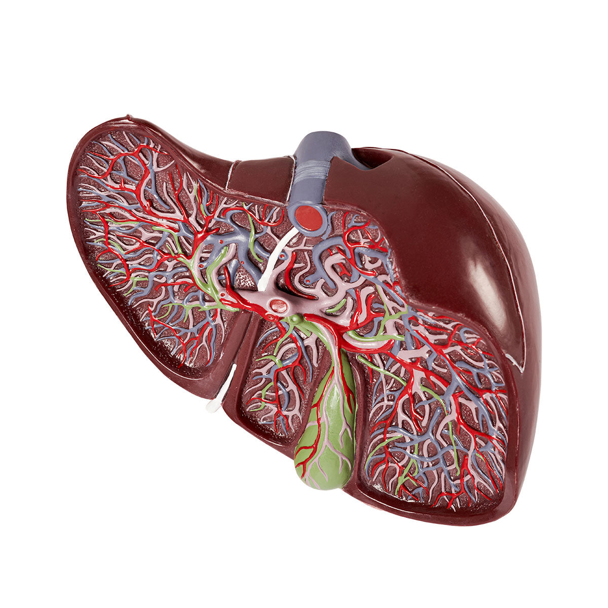Evotech Deluxe Liver Section W/ Gallbladder, 1.5x Life Size