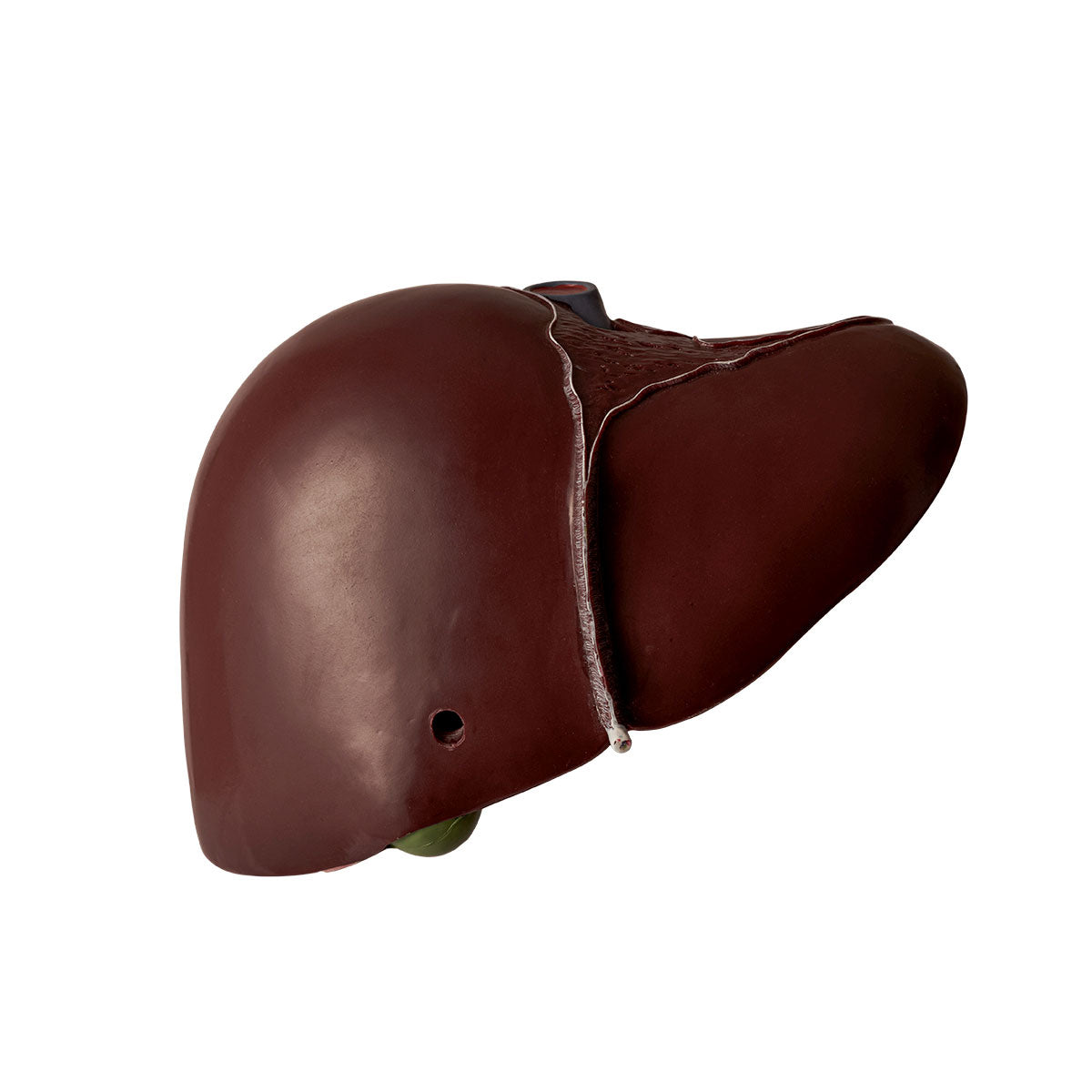 Evotech Deluxe Liver Section W/ Gallbladder, 1.5x Life Size