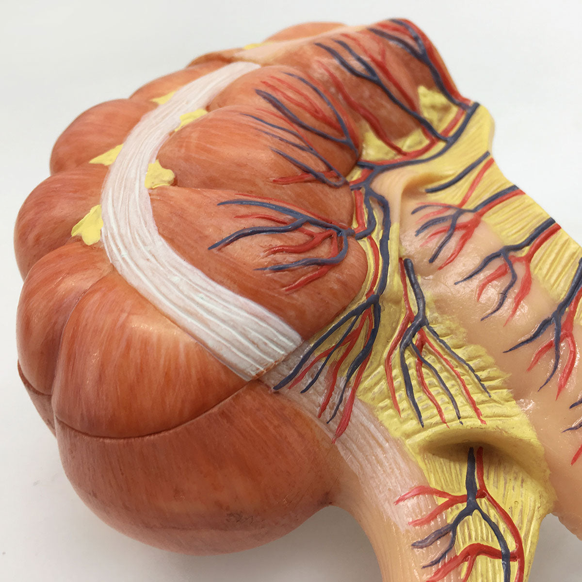 Appendix Model Kit Evotech Scientific Caecum and Appendix Anatomy Model 1.5x Life-size Di ...