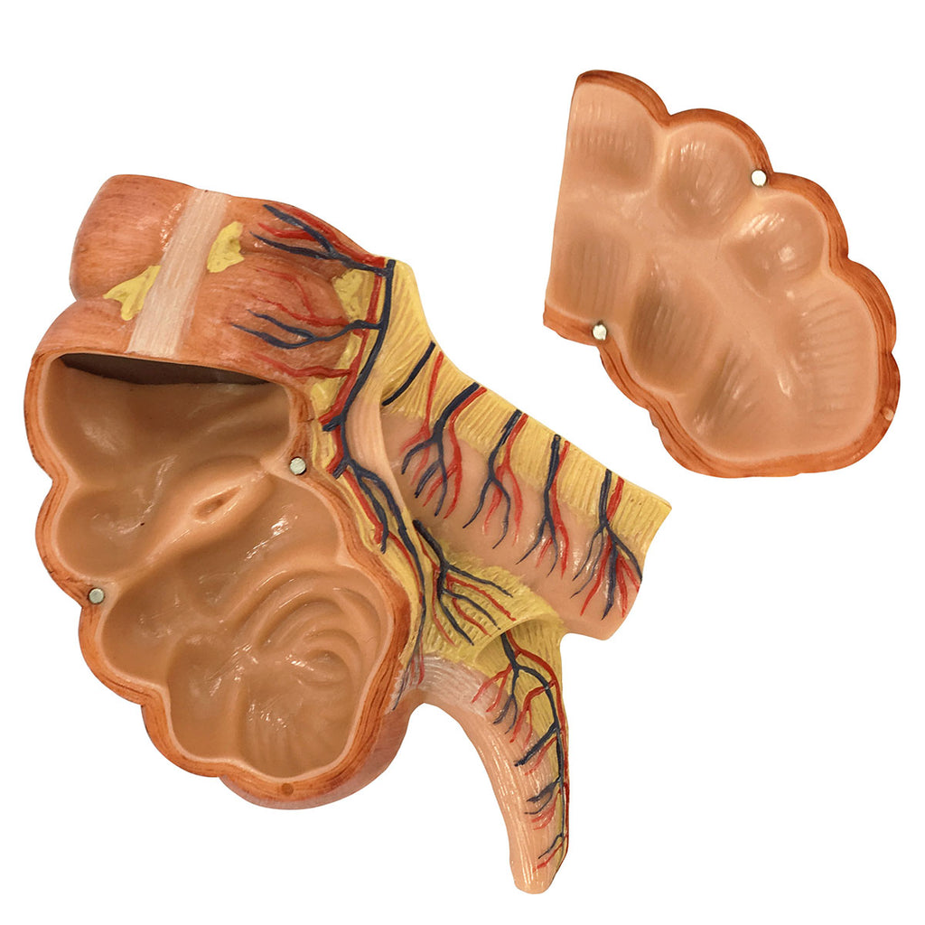 Evotech Scientific Caecum and Appendix Anatomy Model 1.5x Life-size Digestive System Anatomy Model with Appendix
