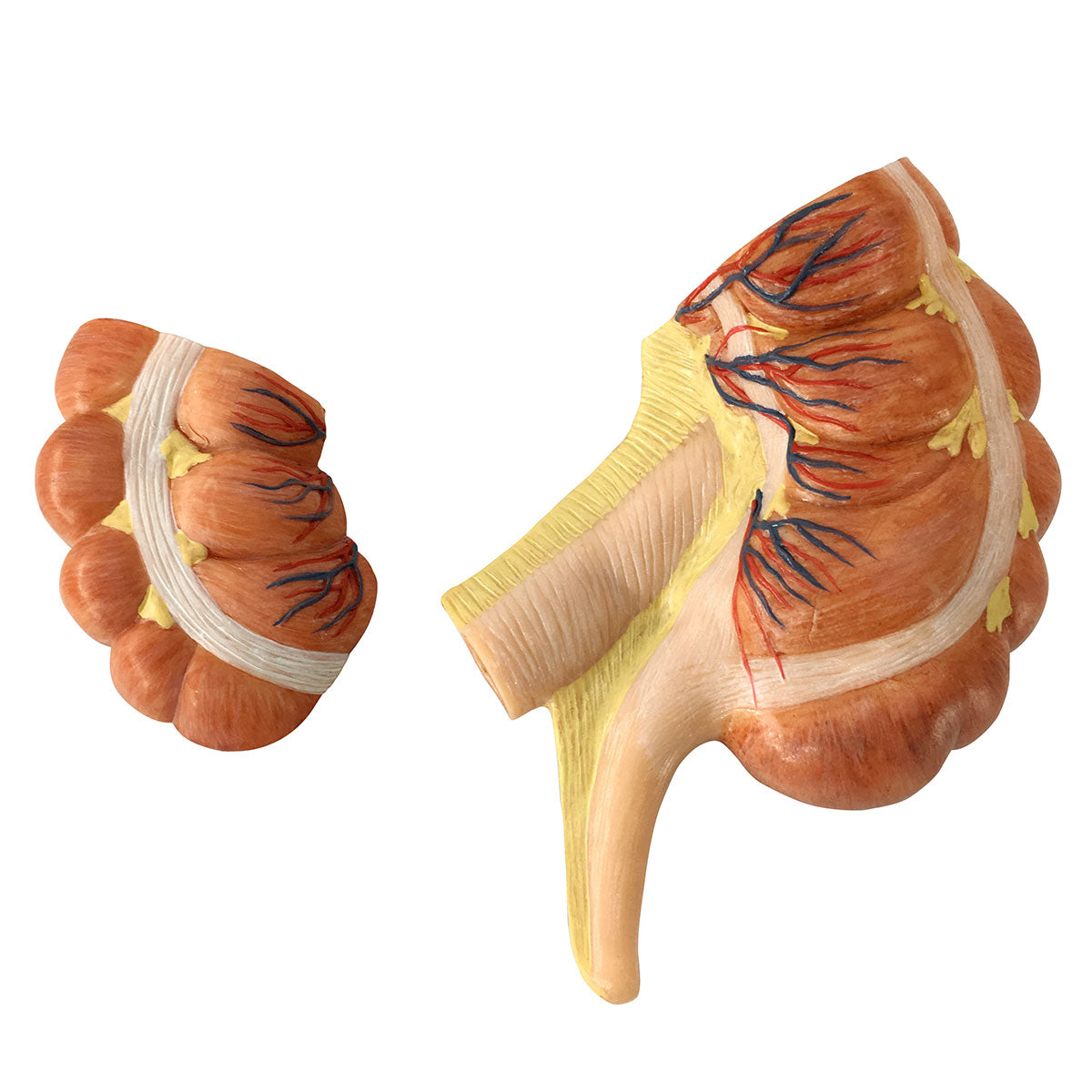 Evotech Scientific Caecum and Appendix Anatomy Model 1.5x Life-size Digestive System Anatomy Model with Appendix