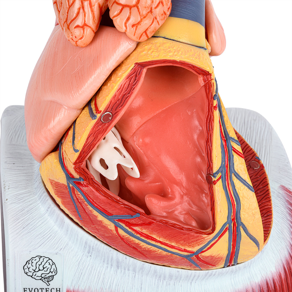 Evotech Scientific Deluxe 10 Parts 1.5X Life Size Large Human Anatomical Heart Model with Thymus Gland & Diaphram Base
