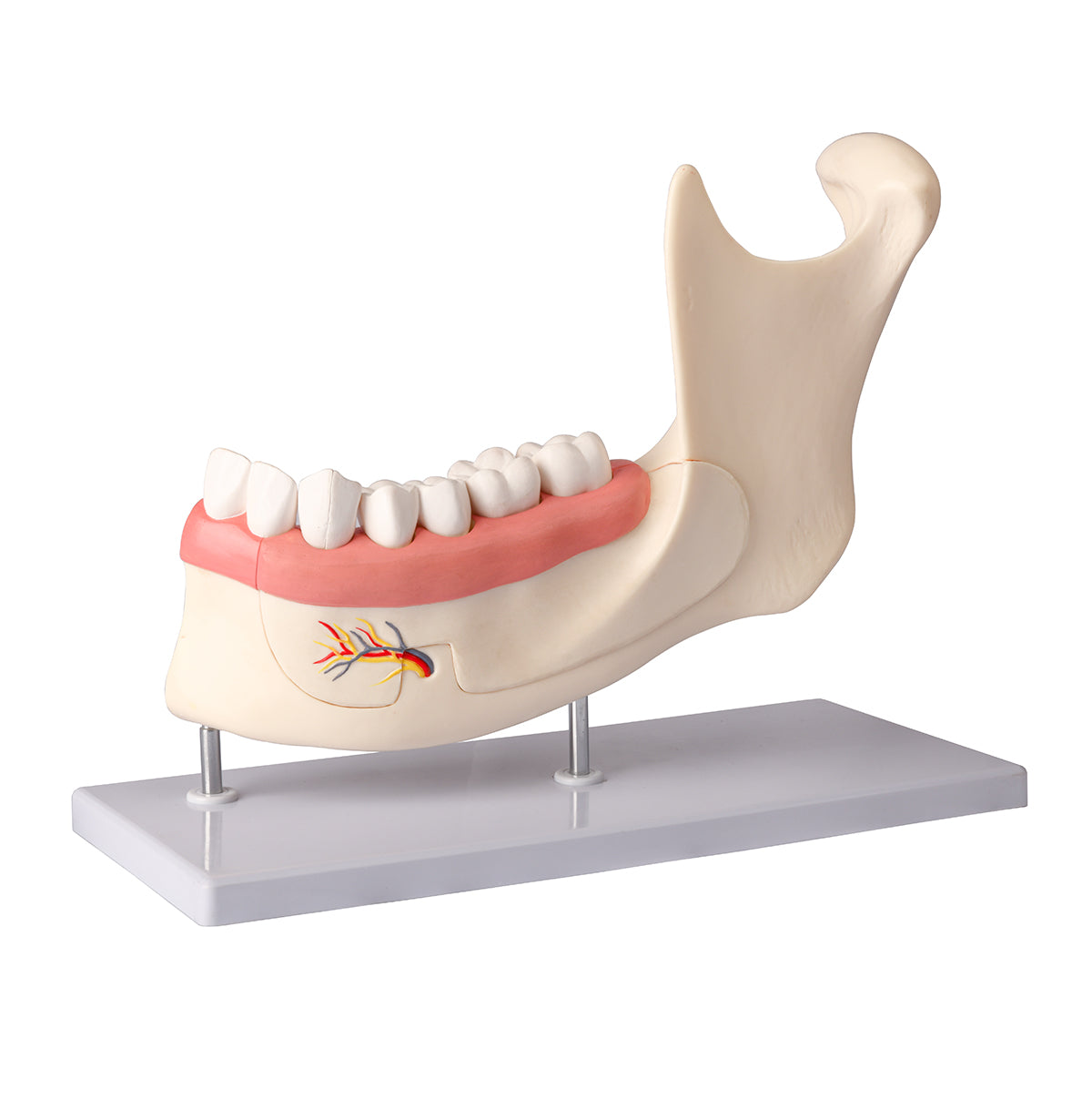 Evotech Scientific Half Lower Jaw W/ Nerve and Removable Teeth , 3x Life Size, 6 Parts