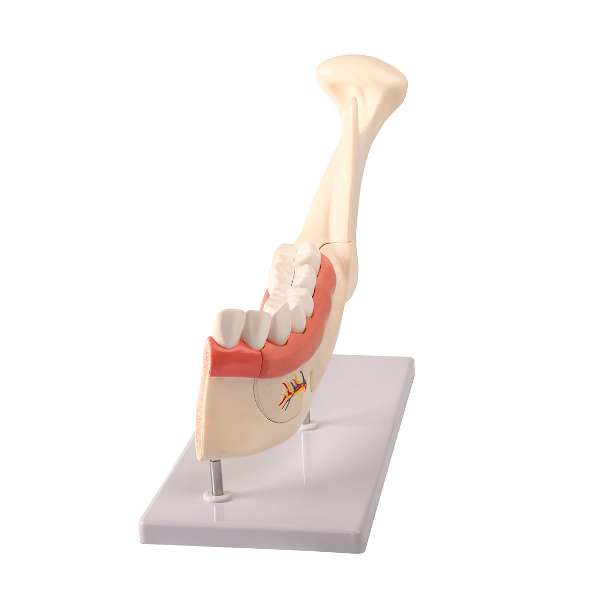 Evotech Scientific Half Lower Jaw W/ Nerve and Removable Teeth , 3x Life Size, 6 Parts