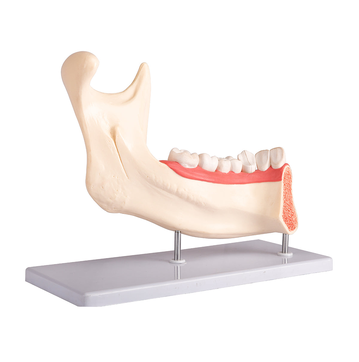 Evotech Scientific Half Lower Jaw W/ Nerve and Removable Teeth , 3x Life Size, 6 Parts