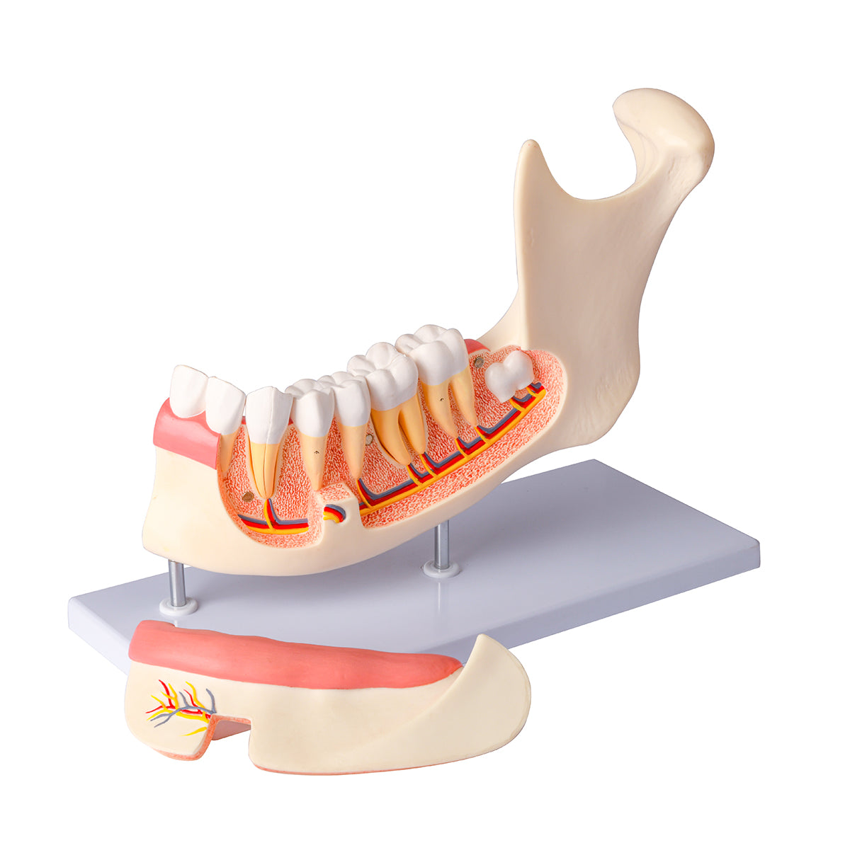 Evotech Scientific Half Lower Jaw W/ Nerve and Removable Teeth , 3x Life Size, 6 Parts