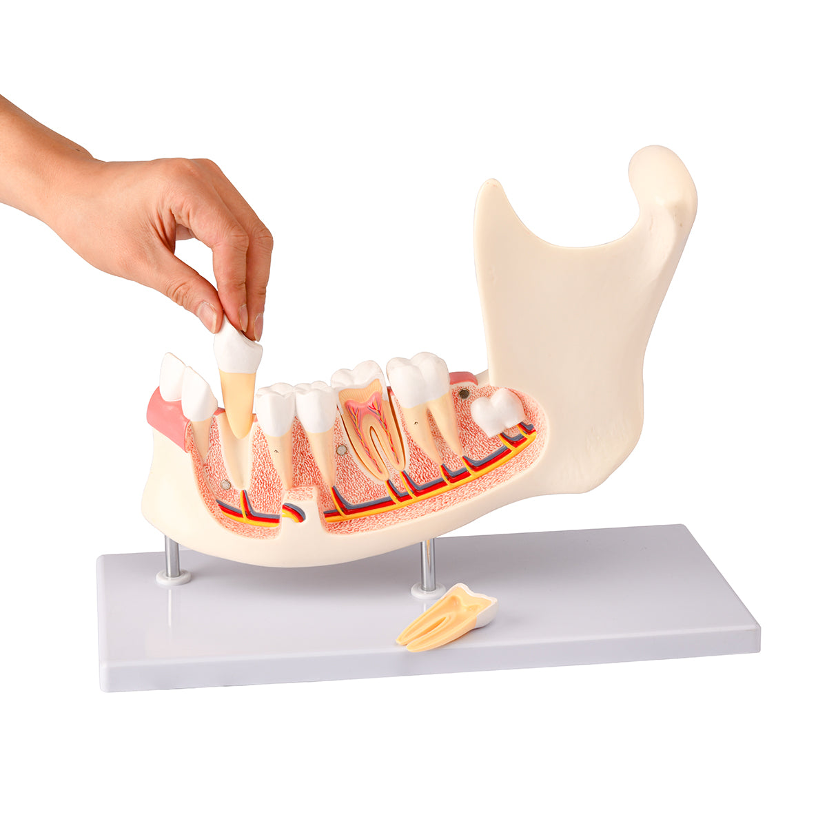 Evotech Scientific Half Lower Jaw W/ Nerve and Removable Teeth , 3x Life Size, 6 Parts