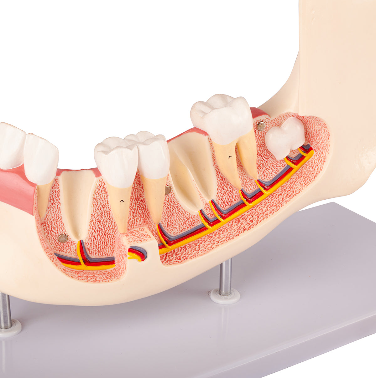 Evotech Scientific Half Lower Jaw W/ Nerve and Removable Teeth , 3x Life Size, 6 Parts