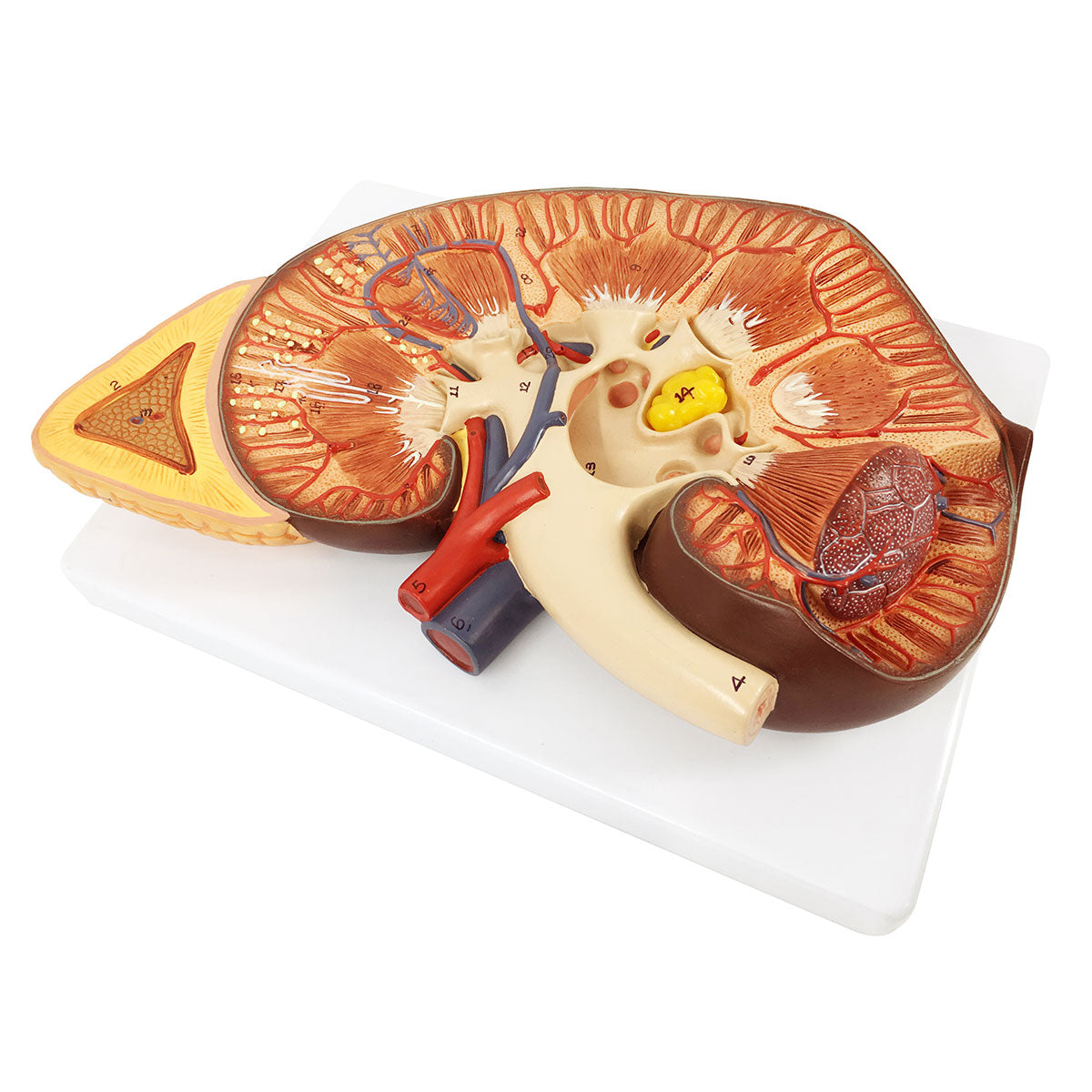 Evotech Scientific Human Kidney Model 3X Life-Size Model Includes Anatomy of Adrenal Gland and Nephrons
