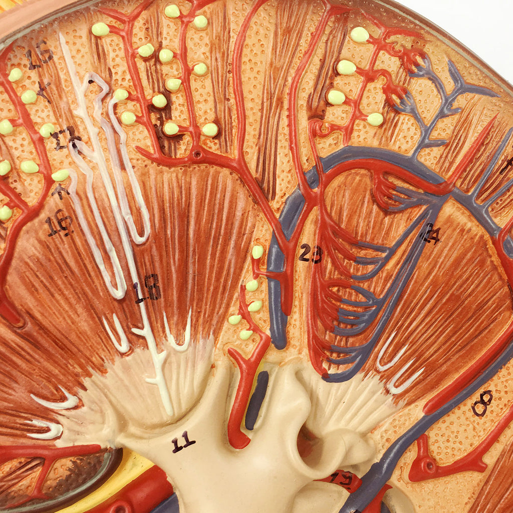 Evotech Scientific Human Kidney Model 3X Life-Size Model Includes Anatomy of Adrenal Gland and Nephrons
