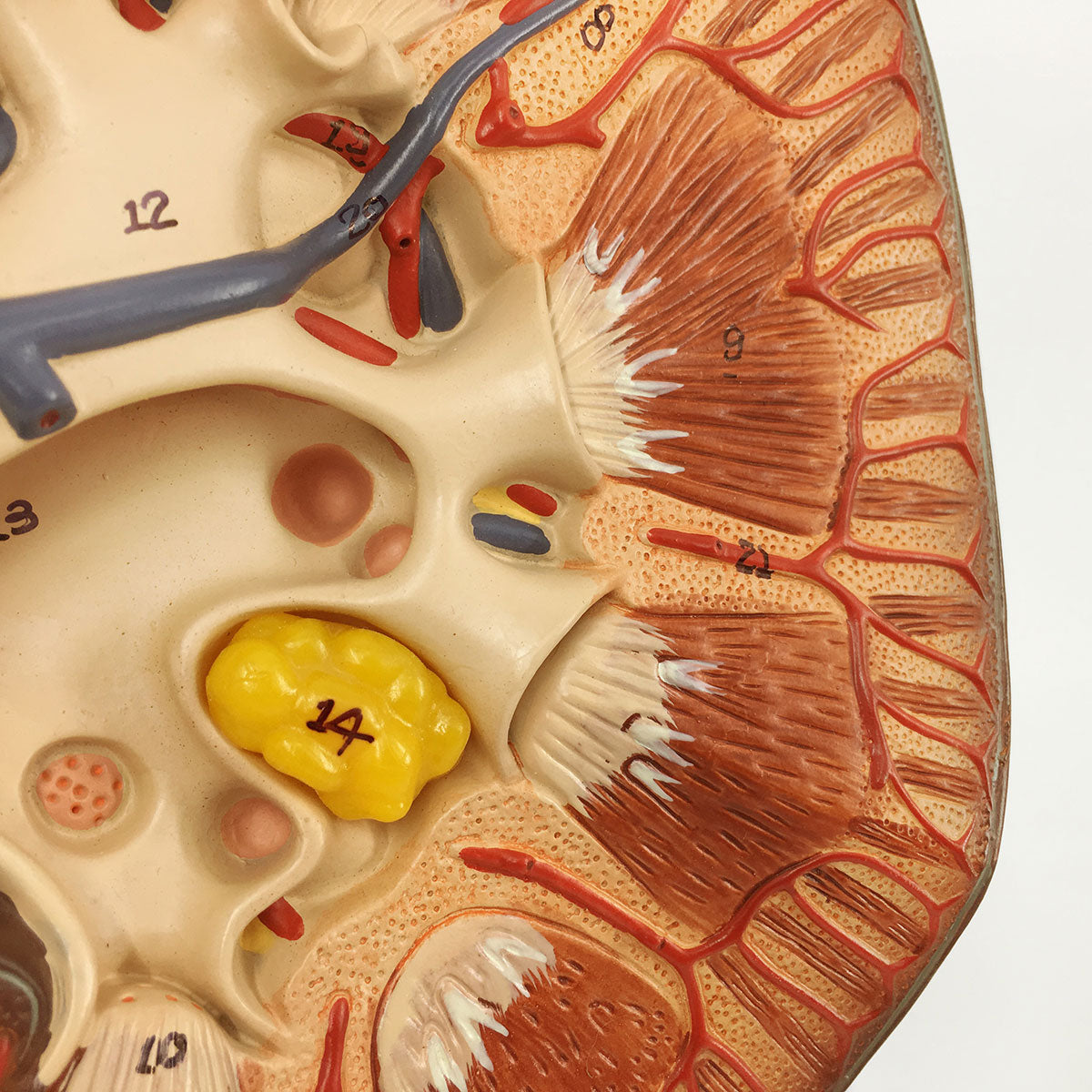 Evotech Scientific Human Kidney Model 3X Life-Size Model Includes Anatomy of Adrenal Gland and Nephrons