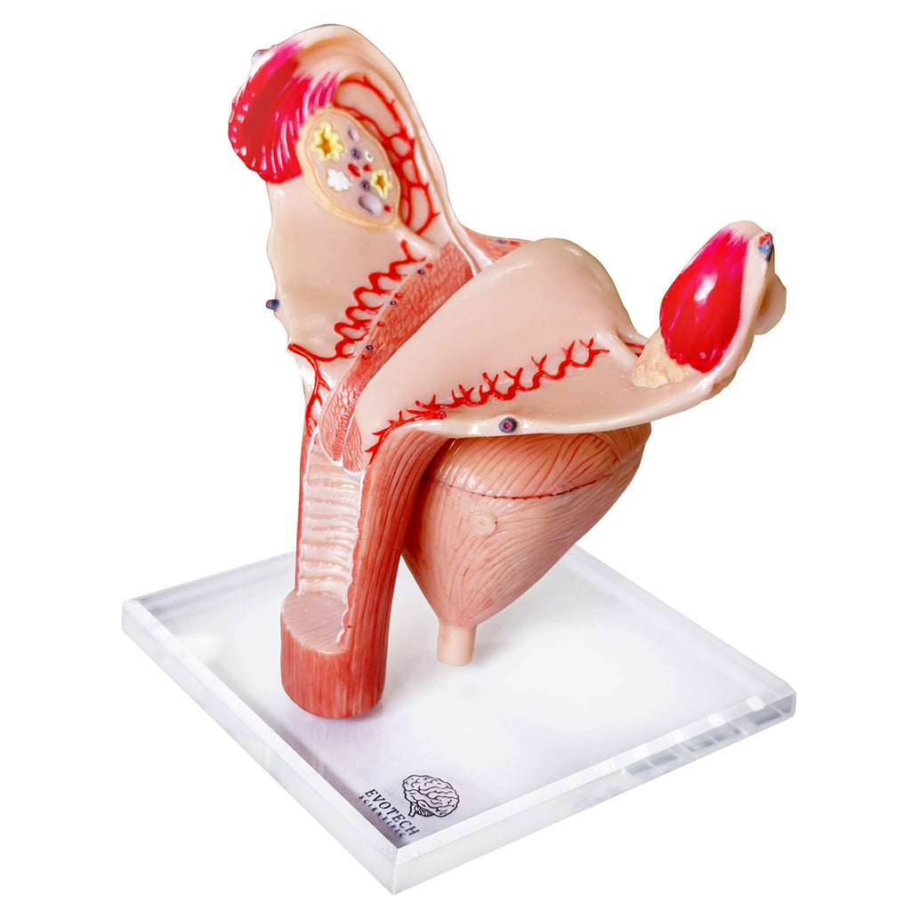 Evotech Scientific Human Uterus Ovary Urinary Bladder Vagina Model On Plexiglass Base