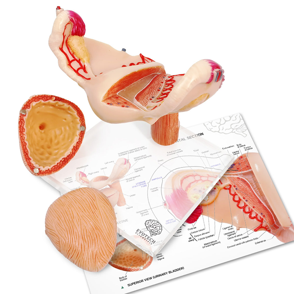 Evotech Scientific Human Uterus Ovary Urinary Bladder Vagina Model On Plexiglass Base