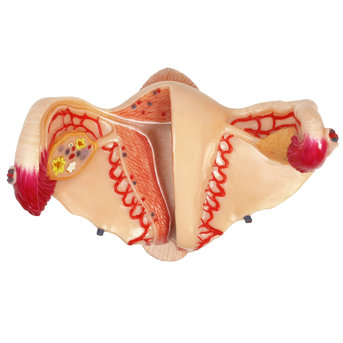 Evotech Scientific Human Uterus Ovary Urinary Bladder Vagina Model On Plexiglass Base