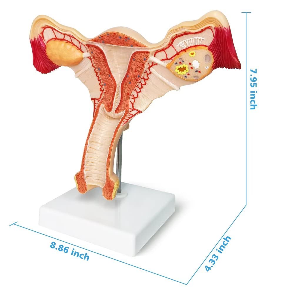 Evotech Scientific Human Uterus and Ovary Model Female Genital Organs Model